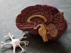 Nutrition directly influences your brain health, according to Robert. Nutrition directly influences your brain health, according to Robert.