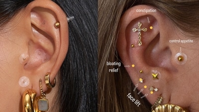 Videos of ear seeding have gone viral online, with some clips reaching millions of views. (Instagram) Videos of ear seeding have gone viral online, with some clips reaching millions of views. (Instagram)