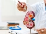 Impaired kidney function contributes significantly to heart disease, a study has revealed. Impaired kidney function contributes significantly to heart disease, a study has revealed.