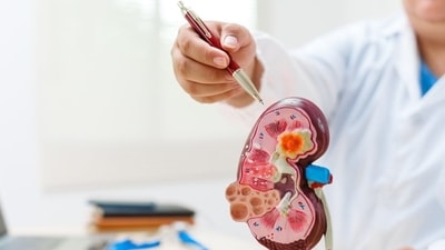 Impaired kidney function contributes significantly to heart disease, a study has revealed. (Shutterstock) Impaired kidney function contributes significantly to heart disease, a study has revealed. (Shutterstock)