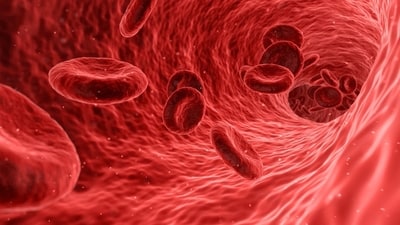 Arterial plaque can be reversed using a targeted approach! (Pixabay) Arterial plaque can be reversed using a targeted approach! (Pixabay)