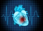 Every minute that passes after a heart attack begins, more of the heart muscle is damaged. 