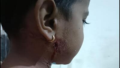4-year-old boy injured in leopard attack in Khed