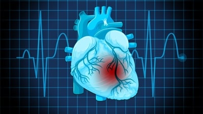 Simple blood test could prevent heart attacks, says longevity expert Dr Vassily. (Freepik) Simple blood test could prevent heart attacks, says longevity expert Dr Vassily. (Freepik)