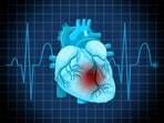 Dr Eliopoulos shares key steps to improve heart health and reduce attack risks. Dr Eliopoulos shares key steps to improve heart health and reduce attack risks.