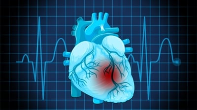 Dr Eliopoulos shares key steps to improve heart health and reduce attack risks. (Freepik) Dr Eliopoulos shares key steps to improve heart health and reduce attack risks. (Freepik)