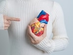 Foods high in salt, sugar and trans fats can slowly narrow your arteries. Foods high in salt, sugar and trans fats can slowly narrow your arteries.