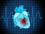 Heart attacks are often caused by hidden plaque, not just blockages, experts warn. Heart attacks are often caused by hidden plaque, not just blockages, experts warn.