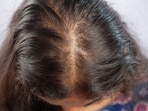 If you don't take care of the troubling after effects of pollution on your scalp, then you are at the risk of hair thinning. If you don't take care of the troubling after effects of pollution on your scalp, then you are at the risk of hair thinning.