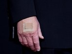 Detail of Donald Trump's hand as he poses on the red carpet for the 2025 Kennedy Center Honors at the John F. Kennedy Center for the Performing Arts in Washington, D.C.