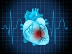 Check out essential winter precautions for people over 50 to avoid heart risks. Check out essential winter precautions for people over 50 to avoid heart risks.