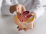 Early detection of colon polyps is key to preventing cancer, says Dr Salhab. 