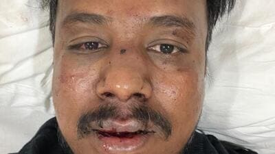 Civic activist assaulted by neighbour in Dadar