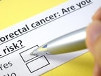 Symptoms of colorectal cancer include blood in stool, changes in bowel habits, unintended weight loss, cramps or abdominal pain.