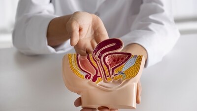 New study finds out which gut bacteria are linked to health and diet. (Freepik) New study finds out which gut bacteria are linked to health and diet. (Freepik)
