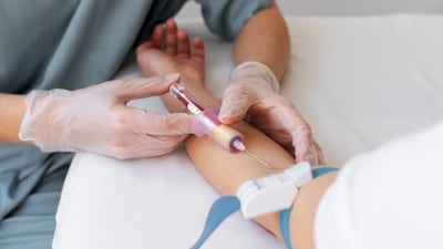 As estrogen levels decline, they have a cascading effect throughout the body, often reflected in laboratory values. (Freepik) As estrogen levels decline, they have a cascading effect throughout the body, often reflected in laboratory values. (Freepik)