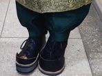To address the problem, doctors designed a modified surgical high ankle boot with special relief at the metatarsal region. (Sourced)
