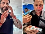 Sejwal's lawyer further claimed that the recent reports and social media posts have misrepresented the incident. 