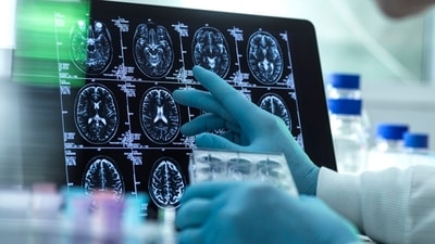A scientist views a patient's brain MRI. A scientist views a patient's brain MRI.