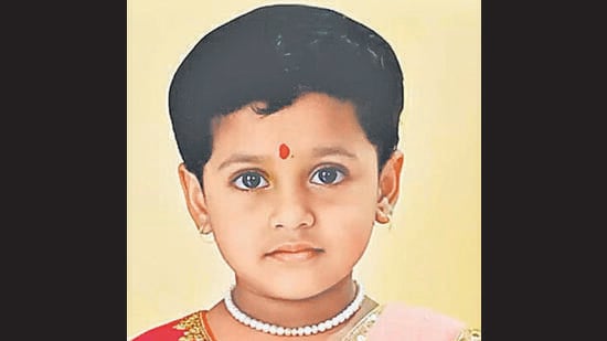 5-year-old girl dies of rabies despite four doses of anti-rabies vaccine