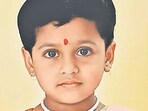 5-year-old girl dies of rabies despite four doses of anti-rabies vaccine