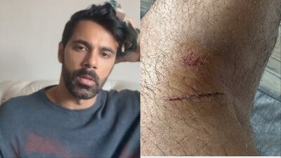 Anuj Sachdeva is known for working in television, films, and web series. Anuj Sachdeva is known for working in television, films, and web series.
