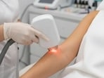 Laser hair removal and a new tattoo: Follow this golden rule to keep your skin and ink safe. (Made using Google Gemini)