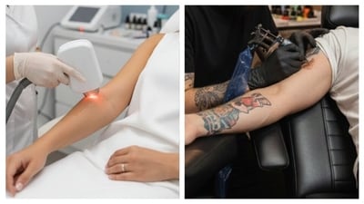 Laser hair removal and a new tattoo: Follow this golden rule to keep your skin and ink safe. (Made using Google Gemini) Laser hair removal and a new tattoo: Follow this golden rule to keep your skin and ink safe. (Made using Google Gemini)