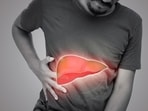 Dr Vyas highlights dangers of moderate drinking after severe liver case of 28-year-old. 
