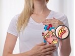 Blocked arteries develop silently over time, often without warning signs. Blocked arteries develop silently over time, often without warning signs.