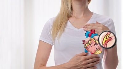 Blocked arteries develop silently over time, often without warning signs. (Adobe Stock) Blocked arteries develop silently over time, often without warning signs. (Adobe Stock)