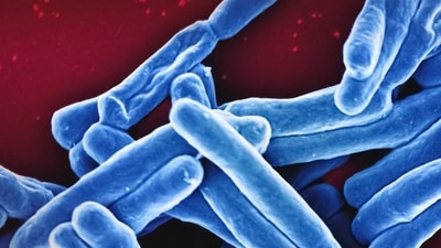 Dr Sehrawat recommends getting tested for a specific bacteria that causes stomach ulcers, if you have persistent symptoms of gastritis. (Unsplash) Dr Sehrawat recommends getting tested for a specific bacteria that causes stomach ulcers, if you have persistent symptoms of gastritis. (Unsplash)