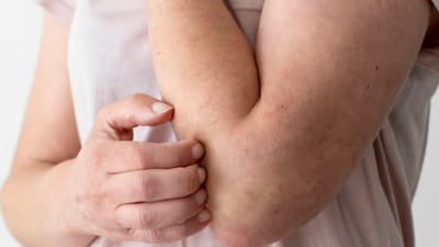 Measles cases rise in the US: Know the symptoms, prevention, and risks (Freepik) Measles cases rise in the US: Know the symptoms, prevention, and risks (Freepik)
