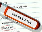 Timely B12 testing essential for energy and brain health, says physician. Timely B12 testing essential for energy and brain health, says physician.