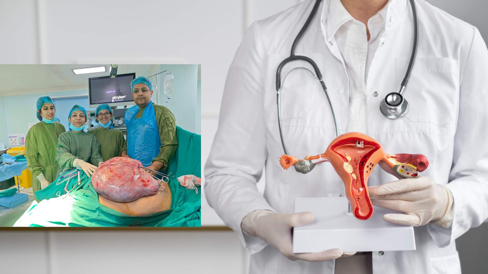 Doctors in a Faridabad hospital treated a giant 16 kg uterine fibroid. (Freepik and Cloudnine Hospital) Doctors in a Faridabad hospital treated a giant 16 kg uterine fibroid. (Freepik and Cloudnine Hospital)