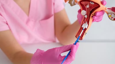 Experts answer the top 7 frequently asked questions about the Pap smear test Experts answer the top 7 frequently asked questions about the Pap smear test