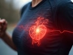 It is a common misconception that heart attacks only affect the chest; the first symptom might actually travel or appear in other areas. 
