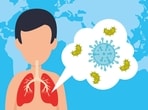 Cold waves pose serious risks for asthma and COPD patients, doctor warns. Cold waves pose serious risks for asthma and COPD patients, doctor warns.