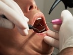 Can your dentist detect endometriosis? Read more to find out! Can your dentist detect endometriosis? Read more to find out!