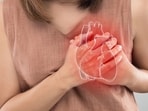 Heart attack symptoms in women are often overlooked, cardiologist warns after patient's close call. 