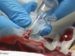 State Blood Transfusion Council issues warning to blood banks against collecting excess blood and transferring it in bulk to other states for profit. ((PIC FOR REPRESENTATION))