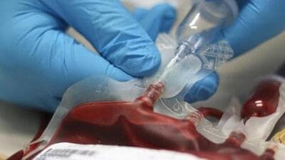 State Blood Transfusion Council issues warning to blood banks against collecting excess blood and transferring it in bulk to other states for profit. ((PIC FOR REPRESENTATION)) State Blood Transfusion Council issues warning to blood banks against collecting excess blood and transferring it in bulk to other states for profit. ((PIC FOR REPRESENTATION))