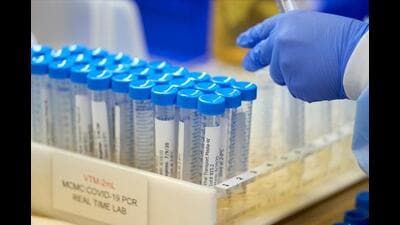 According to the MAPPM, laboratory reports bearing the name, qualifications and signature of a female pathologist - who is registered with the Telangana Medical Council - were received from multiple laboratories in Beed, Nashik, Jalgaon and Chhatrapati Sambhajinagar. (REPRESENTATIVE PHOTO) According to the MAPPM, laboratory reports bearing the name, qualifications and signature of a female pathologist - who is registered with the Telangana Medical Council - were received from multiple laboratories in Beed, Nashik, Jalgaon and Chhatrapati Sambhajinagar. (REPRESENTATIVE PHOTO)