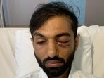 Man arrested after he hurled a stone and left passenger blind in one eye