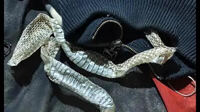 Snake skin on woman’s bed (Sourced)