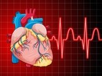 Atrial fibrillation is the most common abnormal heart rhythm in adults. Atrial fibrillation is the most common abnormal heart rhythm in adults.
