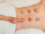 Dr Cyriac Abby Philips shared that true recovery comes from rest, nutrition, and hydration, not from intentionally causing injury through cupping. (Freepik) Dr Cyriac Abby Philips shared that true recovery comes from rest, nutrition, and hydration, not from intentionally causing injury through cupping. (Freepik)