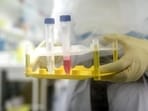 In Kolhapur district, two cath lab facilities will be made available at Gadhinglaj and Seva Hospital in Kolhapur city. The facility will also benefit neighbouring districts, including Sangli, Satara, Sindhudurg and Ratnagiri. (REPRESENTATIVE PHOTO)