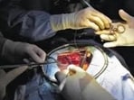 Despite grievous injuries, she later delivered a baby girl. (For representation)