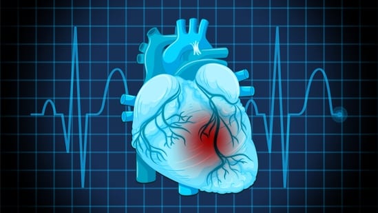 Dr Chiran Babu explains the differences between heart attacks and sudden cardiac arrest (SCA). (Freepik)